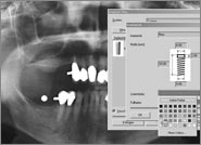 Digitales Röntgen für Implantologie, Oralchirurgie, Parodontologie, Ästhetische Zahnmedizin in Zahnarztpraxis Leick & Leick Frankfurt Höchst